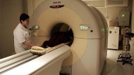 La tomografía detecta el riesgo de sufrir una enfermedad cardiaca
