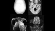 El Homo, único primate cuyo tamaño de dientes decrece al aumentar el de cerebro El Homo, único primate cuyo tamaño de dientes decrece al aumentar el de cerebro