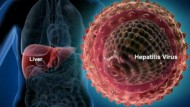 Anticiparse a la hepatitis C